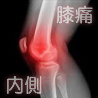 膝関節の痛み（内側）と整体