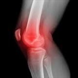 膝関節の痛み（内側）と整体